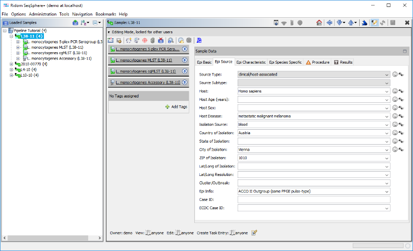 Seqsphere pipeline tutorial import metadata3.png